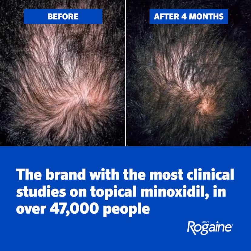 Men's ROGAINE® 5% Minoxidil Topical Foam, Three Month Supply