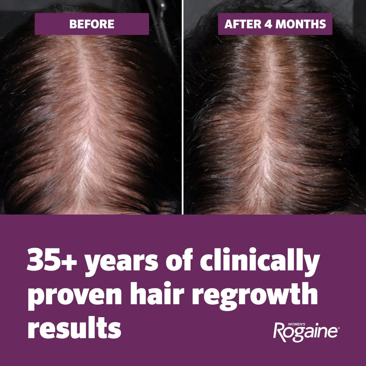 Women's ROGAINE® 5% Minoxidil Topical Foam, Four Month Supply