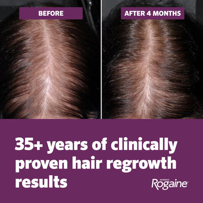 Women's ROGAINE® 5% Minoxidil Topical Foam, Four Month Supply